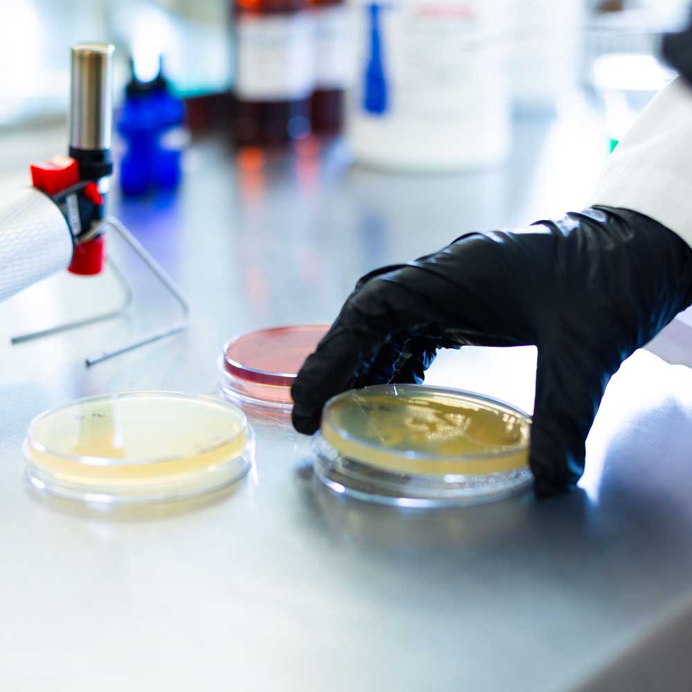 Petri dish Lab Testing